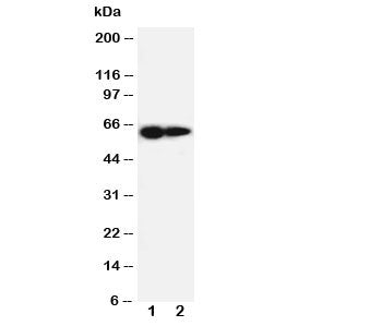 Western blot testing of IL-2 Receptor antibody and Lane 1: PANC cell lysate ; 2: HeLa cell lysate. E