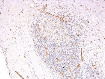 von Willebrand Factor Antibody Cocktail / vWF