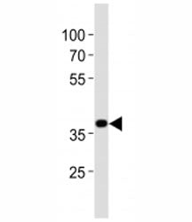 Nkx2.5 Antibody