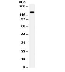 NMDAR2C Antibody / GRIN2C