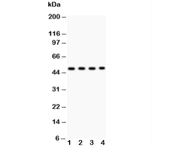 Western blot testing of MBD2 antibody and Lane 1: SGC; 2: HeLa; 3: Jurkat; 4: K562; Predicted/observ