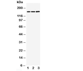 NMDAR2B Antibody