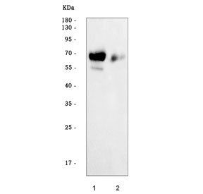 Alpha Fetoprotein / AFP Antibody