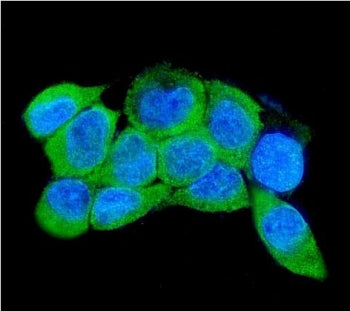 Immunofluorescent staining of FFPE human A431 cells with IRAK2 antibody (green) and DAPI nuclear sta