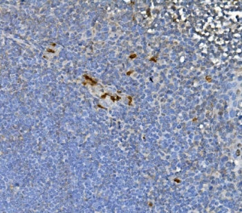 IHC staining of FFPE human tonsil with JUNB antibody. HIER: boil tissue sections in pH8 EDTA for 20 