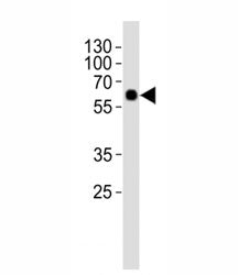 SMAD1 Antibody