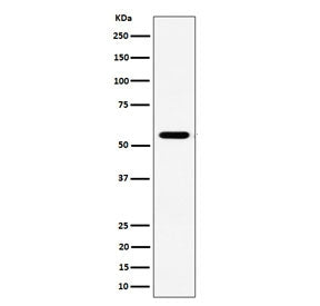 Western blot testing of human Jurkat cell lysate with RNF14 antibody. Predicted molecular weight ~54
