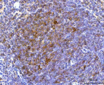 NKp46 Antibody / NCR1