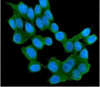 RAB11B Antibody