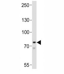 BTK Antibody