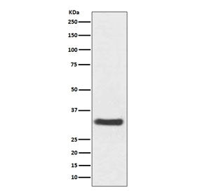 Western blot testing of human SH-SY5Y cell lysate with NQO1 antibody. Predicted molecular weight ~30