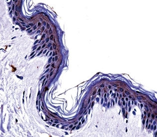 Tyrosinase antibody immunohsitochemistry analysis in formalin fixed and paraffin embedded human skin