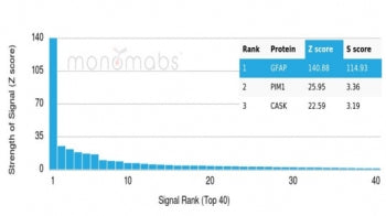 GFAP Antibody / Glial Fibrillary Acidic Protein