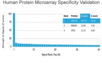 Analysis of HuProt(TM) microarray containing more than 19,000 full-length human proteins using ZNF27