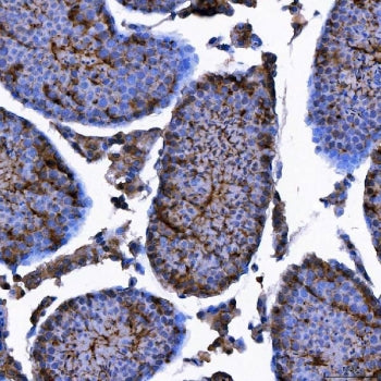 IHC staining of FFPE mouse testis tissue with TRIM71 antibody. HIER: boil tissue sections in pH8 EDT