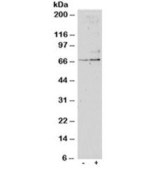 Western blot testing of untreated (left) and TGFBI-treated (right, 1ng/ml, 24hr) primary cultured hu