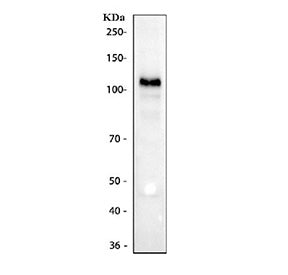 Western blot testing of human K562 cell lysate with CD30 antibody. Predicted molecular weight: 53-12