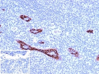 von Willebrand Factor Antibody / vWF