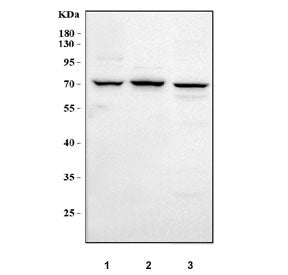 Western blot testing of 1) human SiHa, 2) human RT4 and 3) rat liver tissue lysate with MCCC1 antibo