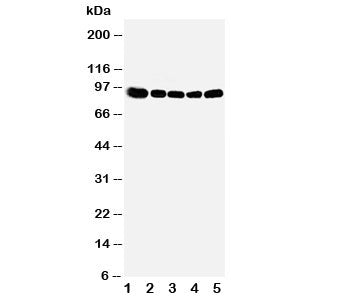 Western blot testing of OSBP antibody and Lane 1: rat kidney; 2: (r) spleen; 3: (r) lung; 4: human H
