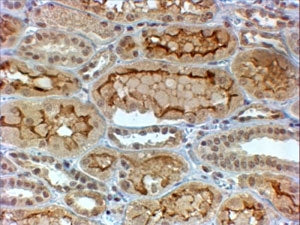 Collagen IV Antibody / COL4A3