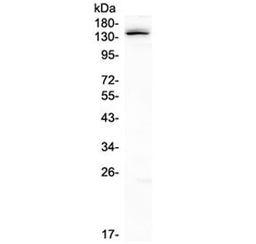 Western blot testing of human K562 cell lysate with LATS1 antibody at 0.5ug/ml. Expected molecular w