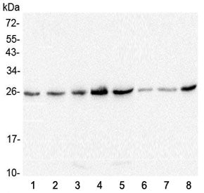 Western blot testing of 1) human HeLa, 2) human T-47D, 3) rat brain, 4) rat lung, 5) rat stomach, 6)