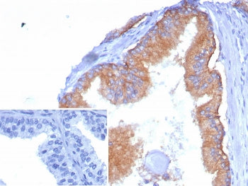 CD38 Antibody