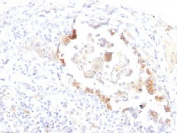 Blood Group Lewis y Antibody