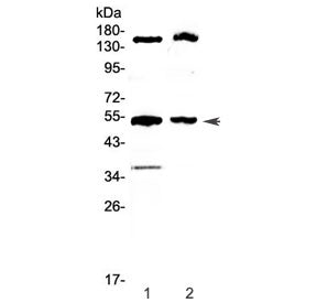 Western blot testing of 1) rat liver and 2) mouse liver lysate with Glucokinase antibody at 0.5ug/ml