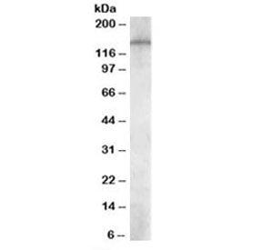 Western blot testing of human temporal cortex lysate with PREX1 antibody at 1ug/ml. Predicted molecu