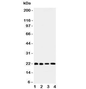 Western blot testing of Bid antibody and human samples 1: HeLa; 2: COLO320; 3: Jurkat; 4: SKOV lysat