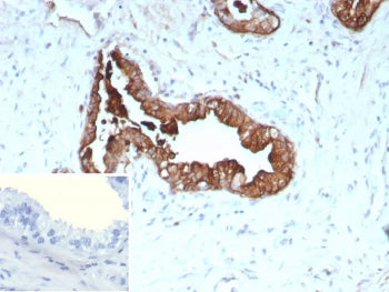 Cytokeratin 19 Antibody