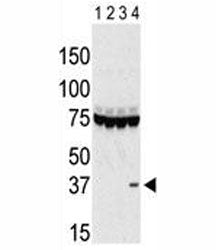 Western blot testing of Aurora-C antibody and lysate of 293 cells expressing 1) Flag tag, 2) Flag-ta
