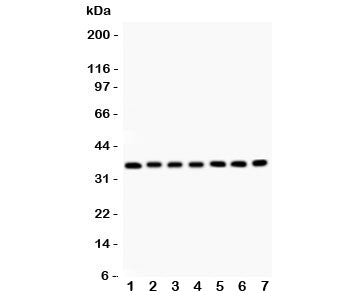 Western blot testing of RACK1 antibody and Lane 1: mouse liver; 2: rat spleen; 3: (m) spleen; 4: hum
