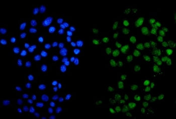Immunofluorescent staining of FFPE human A431 cells with METTL14 antibody (green) and DAPI nuclear s