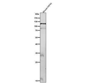 Mouse kidney tissue lysate tested with Phospho-FAK (Tyr576/Tyr577) antibody at 1:2000 dilution for 1