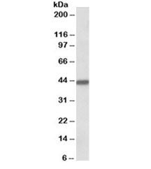 Western blot testing of human breast cancer lysate with Keratin 19 antibody at 0.1ug/ml. Predicted/o