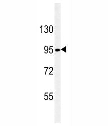 Nephrin antibody western blot analysis in SK-BR-3 lysate. Ab used at 1:100 dilution. Predicted molec