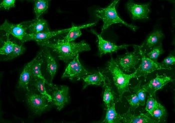 Fibrillarin Antibody / FBL