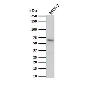Western blot testing of human MCF7 cell lysate with Estrogen Receptor alpha antibody (clone ESR1/190