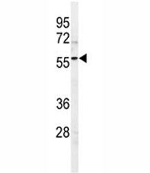 Western blot analysis of SPHK1 antibody and 293 lysate. Predicted molecular weight: ~43/51/44kDa (is