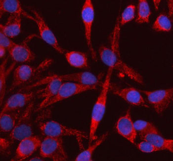 Immunofluorescent staining of RIG using anti-RIG antibody (red). RIG was detected in an immunocytoch