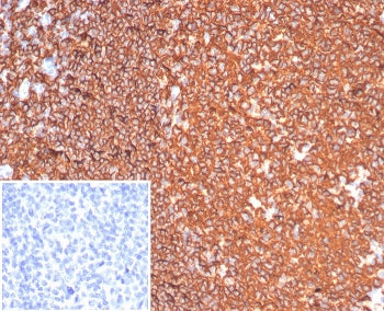 IHC staining of FFPE human tonsil tissue with CD20 antibody (clone MS4A1/6993R). Inset: PBS used in 