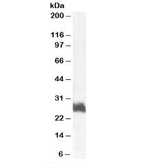 Western blot testing of human bone marrow lysate with FRA1 antibody at 1ug/ml. Predicted molecular w