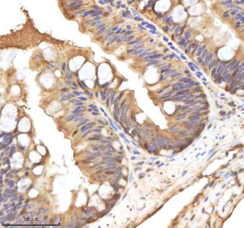 IHC staining of zebrafish Hand2 protein using Zebrafish Hand2 antibody, HRP-labeled secondary and DA
