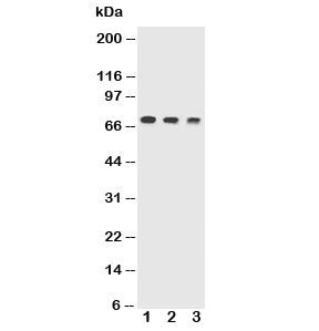 Western blot testing of Trem1 antibody and Lane 1: recombinant mouse protein 10ng; 2: 5ng; 3: 2.5ng.