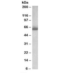 Western blot testing of human testis lysate with BBS4 antibody at 1ug/ml. Predicted molecular weight