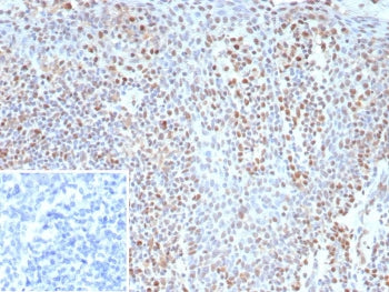 Bcl6 Antibody
