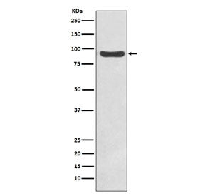 Western blot testing of human HeLa cell lysate with IKKb antibody. Predicted molecular weight ~87 kD